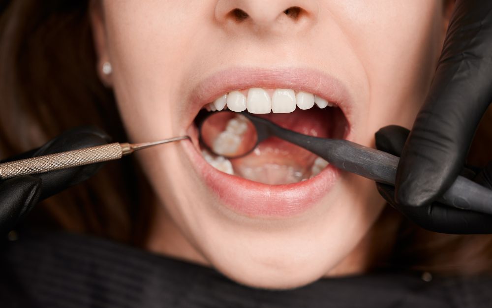 Signs your wisdom tooth needs to be removed