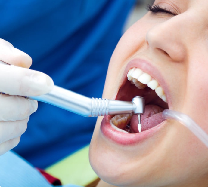 Brace Yourself can provide restorative care such as tooth fillings