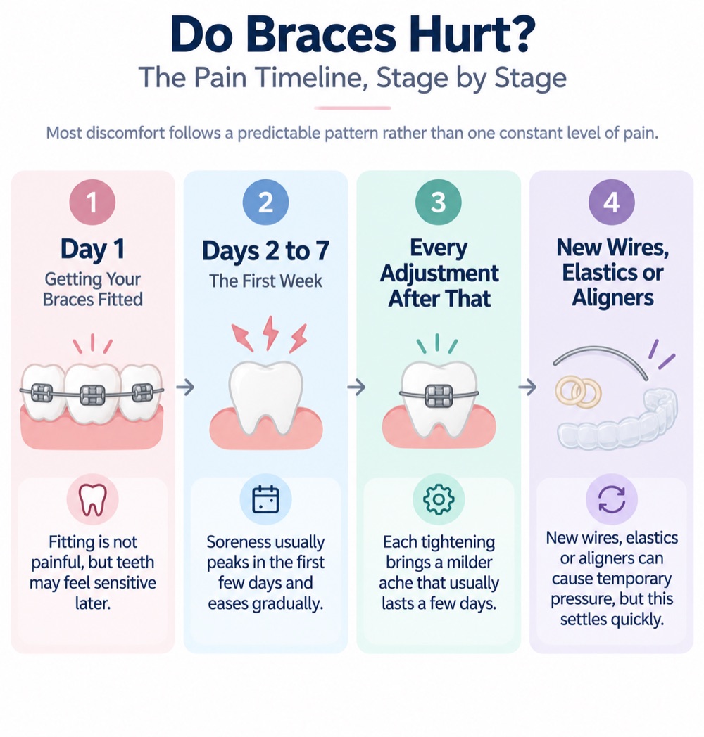 Every stage of the pain timeline of braces